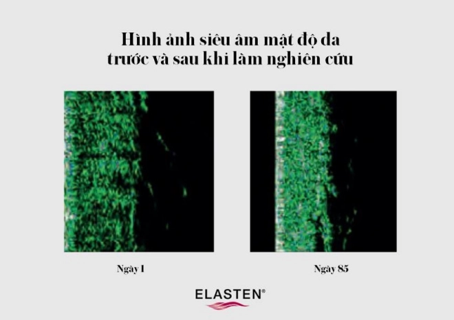 elasten-collagen-8